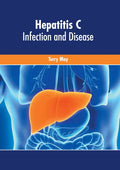 Hepatitis C: Infection and Disease - Hardcover