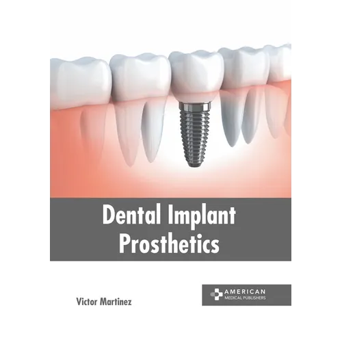 Dental Implant Prosthetics - Hardcover