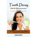 Tooth Decay: How to Heal Cavities and Reverse Tooth Decay (How I Stopped Tooth Decay and Avoided Dental Surgery With This All Natural) - Paperback
