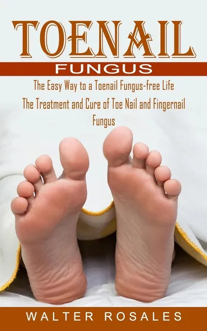 Toenail Fungus: The Easy Way to a Toenail Fungus-free Life (The Treatment and Cure of Toe Nail and Fingernail Fungus) - Paperback