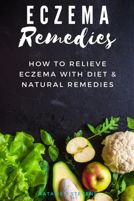 Eczema Remedies: How to Relieve Eczema With Diet & Natural Remedies - Paperback