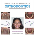 Invisible TransForce Orthodontics - Hardcover