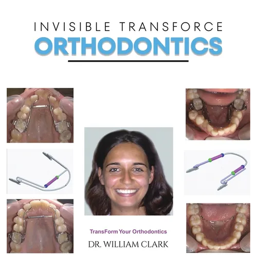 Invisible TransForce Orthodontics - Hardcover