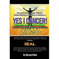Yes I Cancer: You can't beat cancer without chemotherapy, radiation or surgery - Paperback