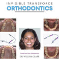 Invisible TransForce Orthodontics - Paperback