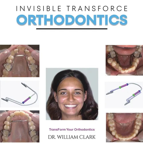 Invisible TransForce Orthodontics - Paperback