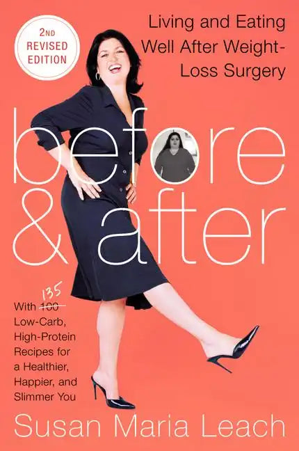 Before & After, Second Revised Edition: Living and Eating Well After Weight-Loss Surgery - Paperback